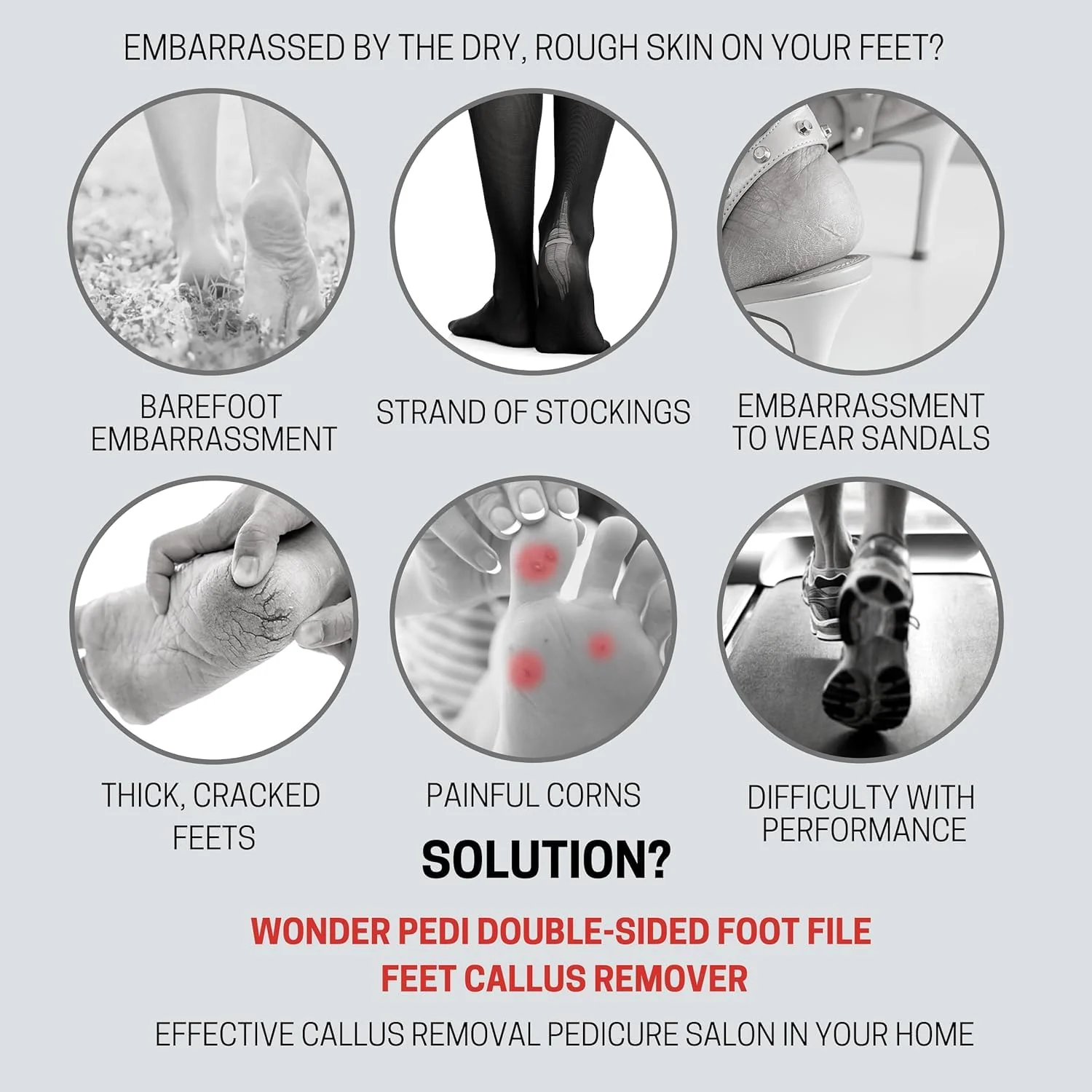 Dual Sided Foot File – Effective Dead Skin Removal & Smoothing - Image 7